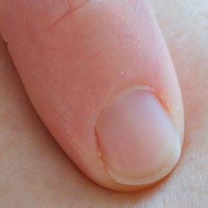 Nail Extensions